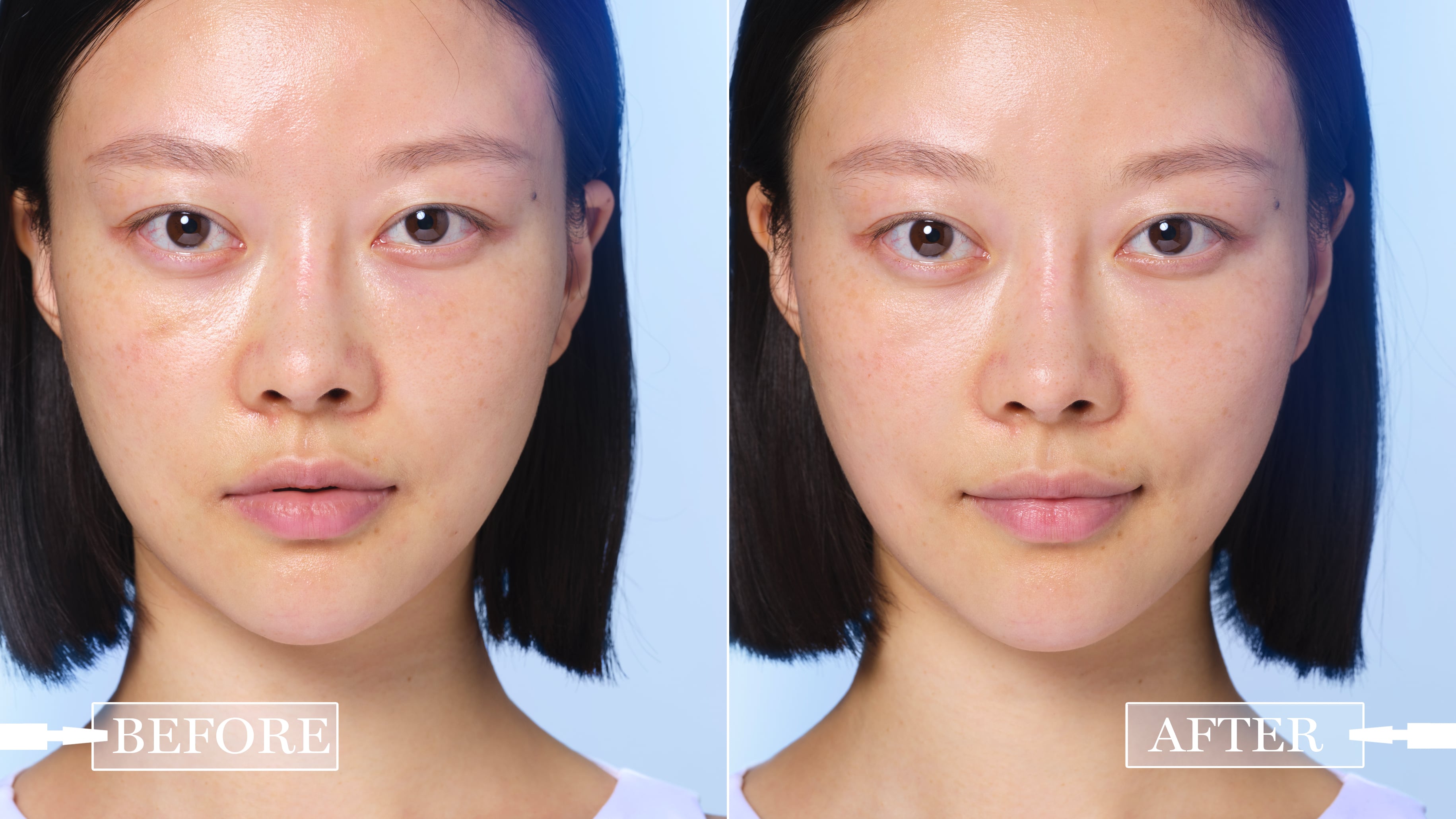 BEFORE / AFTER